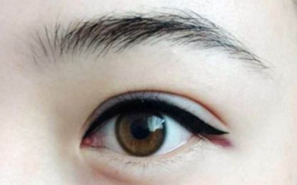 南寧醫(yī)科大雙眼皮整形費(fèi)用及技術(shù)綜述！名單與收費(fèi)指南分享