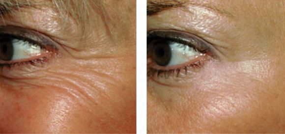 深圳最佳醫(yī)療機(jī)構(gòu)排名，熱瑪吉治療哪家醫(yī)院效果好？