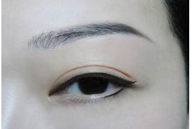 成都鼻頭縮小整形診所推薦！頂尖醫(yī)生揭秘排行榜前三強