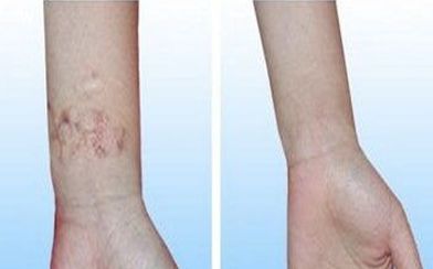 2023年武漢脫發(fā)治療獨(dú)家名單曝光！醫(yī)術(shù)嫻熟，聲譽(yù)遙遙領(lǐng)先！