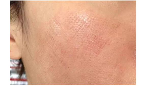 貴陽(yáng)豐鼻醫(yī)生推薦TOP7專家候選已鎖定，屆時(shí)欽點(diǎn)！