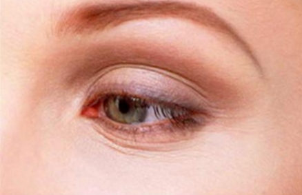 長沙溫宏醫(yī)療整形美容醫(yī)院：為什么選擇整形手術(shù)呢？整形手術(shù)真的安全嗎？