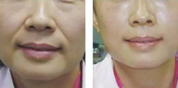 青島鼻修復(fù)：頂級(jí)專家實(shí)力享譽(yù)！唇齒相依的實(shí)力推薦