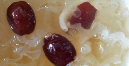 洪曉婭醫(yī)生的特長和面部整形案例分享