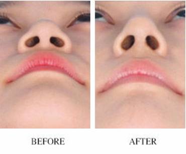 2023年前10家廈門(mén)專(zhuān)業(yè)無(wú)痕祛眼袋醫(yī)院排名清單發(fā)布！整個(gè)廈門(mén)當(dāng)之無(wú)愧的醫(yī)院推薦榜單！