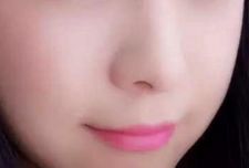 杭州哪家醫(yī)院割雙眼皮效果出眾？推薦藝星、時光、格萊美等受歡迎醫(yī)療機構(gòu)