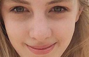 三亞心夢(mèng)醫(yī)學(xué)院醫(yī)師劉濤揭秘受歡迎的吸脂手術(shù)案例分享