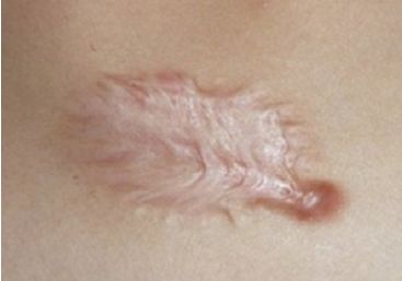 天津市最受歡迎的雙眼皮整形醫(yī)院排行榜發(fā)布，熱度爆表！