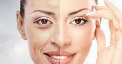 成都賈德淵醫(yī)生的眼睛技術(shù)有何不同？80天變化詳解