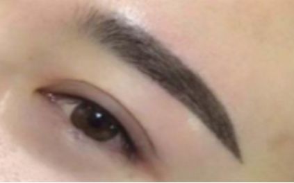 天津植發(fā)專家推薦！醫(yī)院排行榜公布讓你找到權(quán)威正規(guī)植發(fā)機(jī)構(gòu)