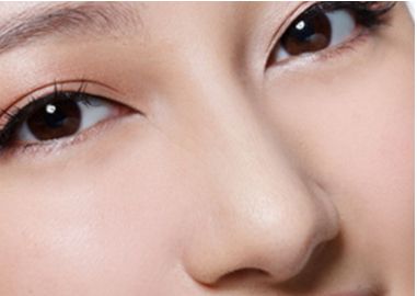 雙眼皮手術需謹慎！了解手術常見風險