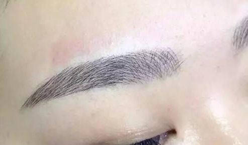 昆明祛斑哪家醫(yī)院更受歡迎？大眾口碑告訴你答案！