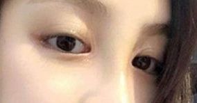 如何選擇合適的醫(yī)生，讓你的身材變得完美無暇