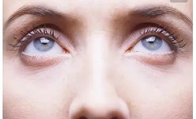 崔向葵雙眼皮整形手術(shù)效果如何？了解一下!