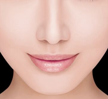 哈醫(yī)大四院李巍主治醫(yī)生鼻整形手術(shù)！80天重塑完美鼻型全記錄！