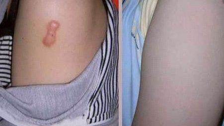 上海知名醫(yī)生手術(shù)CG費(fèi)用曝光，驚人低價(jià)吸引眾多患者！