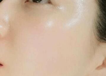 邯鄲有哪些值得推薦的吸脂整形醫(yī)院？整形醫(yī)院的選擇有哪些指標？