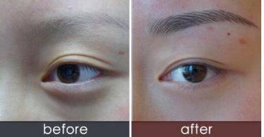 煙臺市區(qū)激光祛斑醫(yī)院排行榜，信譽好的醫(yī)療機構高效激光祛斑大解密