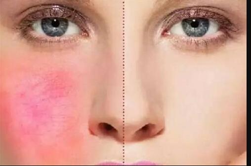 榆林雙眼皮修復(fù)誰的技術(shù)更值得信賴？