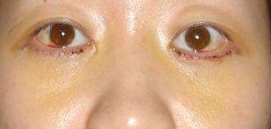 重慶鼻部整形十大備受推崇的醫(yī)生，擔(dān)當(dāng)醫(yī)界翹楚技藝無敵