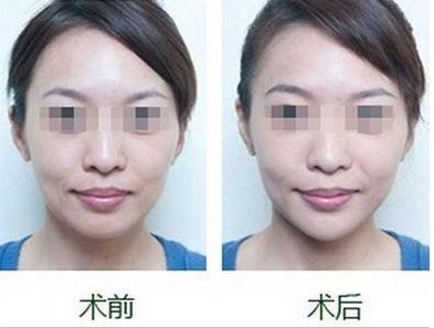 首屈一指的醫(yī)院！揭秘北京植發(fā)領(lǐng)域排名靠前的頂級機(jī)構(gòu)