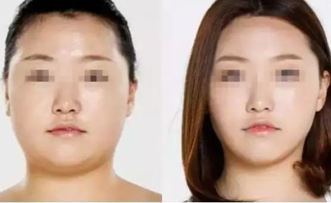 寧波2023年抽脂醫(yī)生排名揭曉！這幾位口碑爆棚的專家堪稱翹楚！