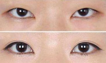 矚目！莊洪興醫(yī)生的綜合評價和形象考察