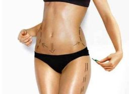 齊魯醫(yī)院大腿抽脂案例分享：專家解析、費用說明、效果好嗎