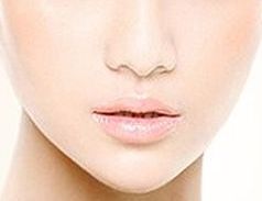 整形技術首席專家白明，美麗改造雙眼皮效果如何？案例分析大揭秘！