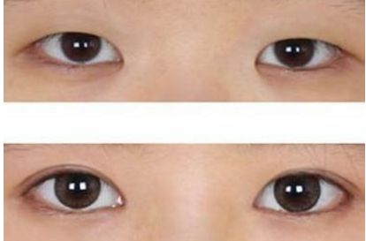 哪家整形醫(yī)院是濟南市最受信賴的？三大醫(yī)療機構(gòu)曝光！