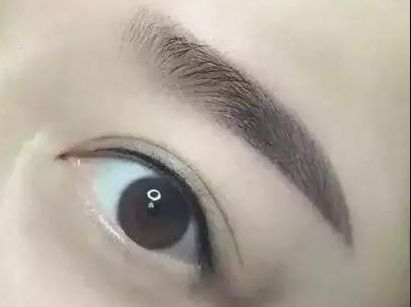 護(hù)眼實踐：林琦東如何改善視力？真實案例揭示眼部整形費用