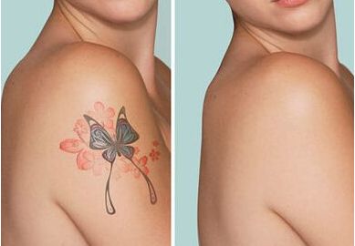 成都寶尼達(dá)授權(quán)注射醫(yī)生名錄公布  精選醫(yī)生簡(jiǎn)介一覽