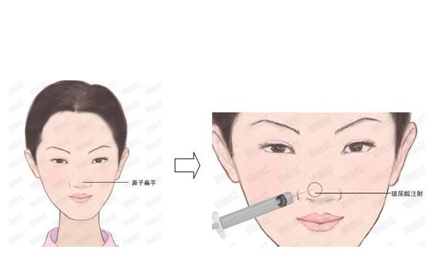 河南省整形醫(yī)院推薦：華領(lǐng)、維多利亞與締萊美大放異彩！