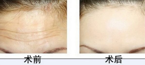 廣州正頜手術(shù)醫(yī)院排行榜：權(quán)威專家推薦，火爆熱門醫(yī)院解析