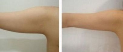 西部戰(zhàn)區(qū)一流眼科專家介紹，技術(shù)評估及收費參考