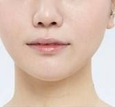 安徽省雙眼皮整形醫(yī)院，網(wǎng)友推薦熱門醫(yī)療中心排名前三