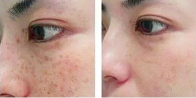 上海華美醫(yī)療美容醫(yī)院注射玻尿酸的醫(yī)生推薦，想了解一下嗎？