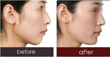 深圳哪些醫(yī)生已獲得2023年喬雅登認(rèn)證？全新名單發(fā)布！