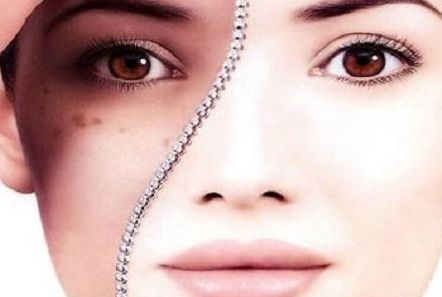 秦皇島一家專業(yè)整形醫(yī)療機(jī)構(gòu)的雙眼皮手術(shù)效果如何，哪位醫(yī)生技術(shù)高超？了解手術(shù)價(jià)格可供參考