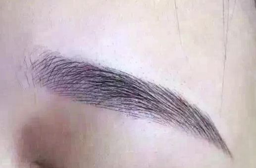 長沙脂肪吸取專家揭秘：技術(shù)卓越，無數(shù)口碑背后的醫(yī)美奇跡！