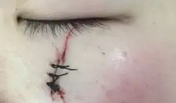 南京智美顏：了解2023吸脂案例曝光，發(fā)現(xiàn)醫(yī)療美容的驚人效果！