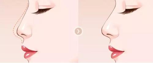 寧波韓美整形吸脂值得信賴嗎？