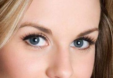 王玉潔醫(yī)生的雙眼皮技術及成功案例分享