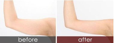 上海藝星醫(yī)療美容的口碑如何？醫(yī)術(shù)是否值得信賴(lài)？哪位醫(yī)生水平較高？