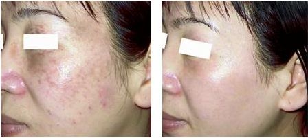 醫(yī)生付德剛面雕案例揭露！技術如何？詳細信息公布，附醫(yī)院詳解！