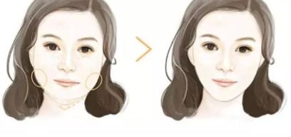 石家莊雙眼皮二次修復首選！排行榜公布最佳八強名單