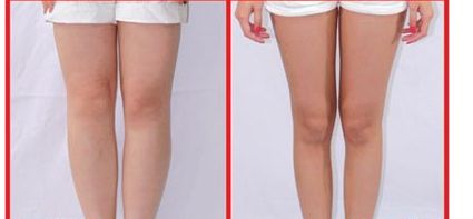 昆山人民醫(yī)院美容科提供哪些整形項(xiàng)目？著名醫(yī)師坐診+讓您雙眼煥發(fā)迷人魅力！