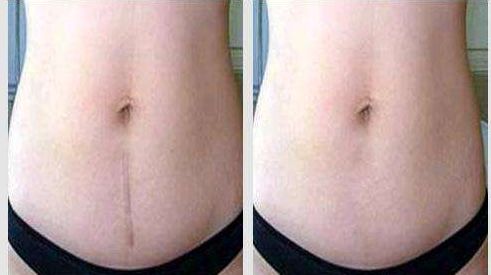 深圳很受推崇的雙眼皮修復(fù)醫(yī)生榜單發(fā)布！探尋盡善盡美之道