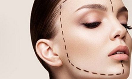 薛紅宇雙眼皮整形，獨特技術(shù)展示令人驚嘆