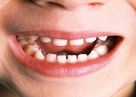 整形世界中，張笑天下頜角整形大概需要多少費(fèi)用？醫(yī)院技術(shù)是如何保障的？